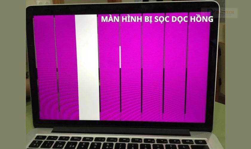 Màn hình laptop bị sọc dọc màu hồng