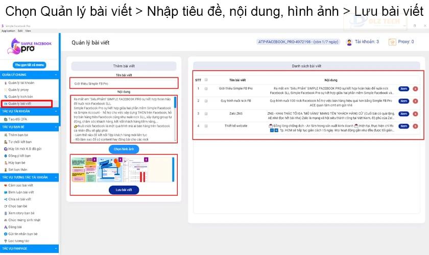Quản lý bài viết